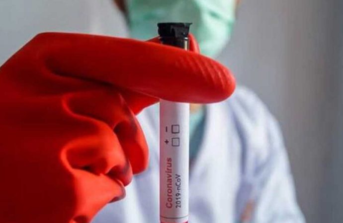 Artış devam ediyor! İşte günlük koronavirüs tablosu
