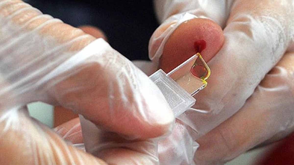 Tıp dünyasında şok: Standart testlerin kaçırdığı nadir kan grubu Tayland’da bulundu