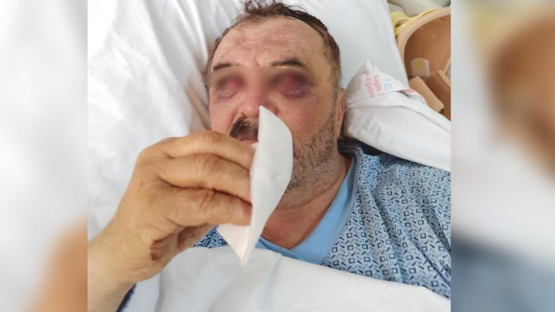 Operasyonda gözaltına alındıktan sonra helikopterden atıldıkları iddia edilmişti; hastane raporları yüksekten 