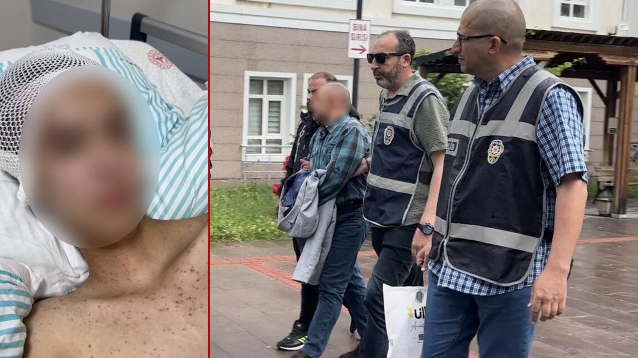 Komadan çıktı, anlattıkları dehşete düşürdü! İstismara direndiği için vurulduğunu söyledi