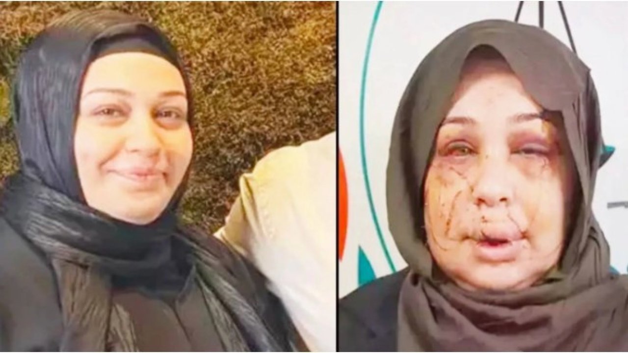 Eşine işkence yapan Cumhurbaşkanlığı Koruma Dairesi personeline ödül gibi ceza!