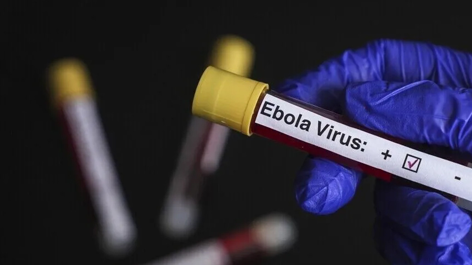 DSÖ’den Ebola Alarmı: KDC’de 5 Bin 794 Vaka ve 2 Bin 786 Ölüm!