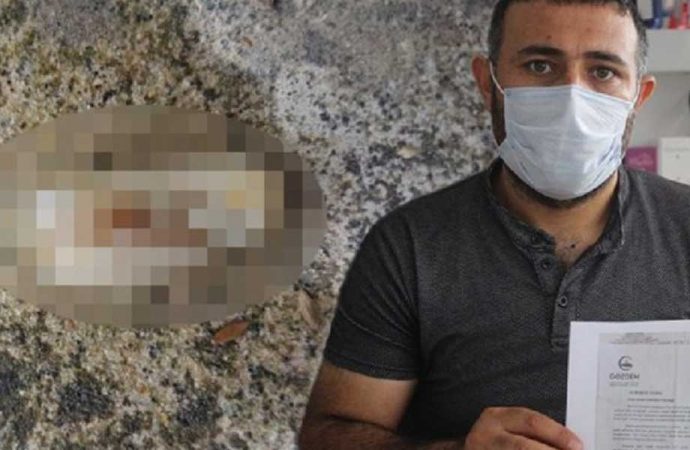 Fabrikanın işçilere verdiği yemekten ‘insan parmağı’ çıktı