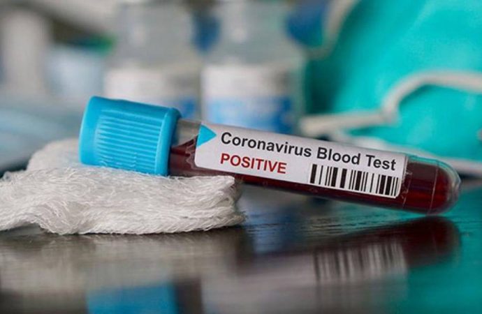Koronavirüs hastaları için yeni önlemler: Pozitif bileklik ve kutu uygulaması