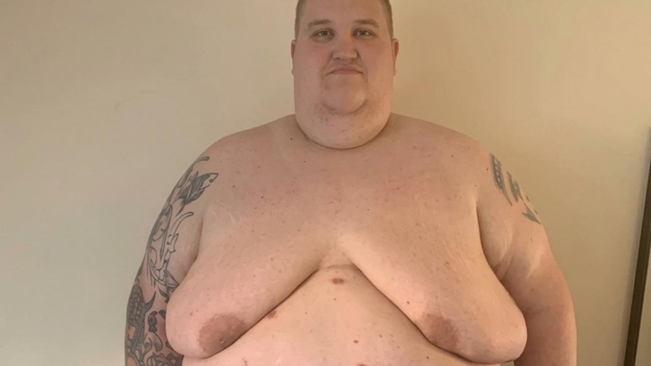 298 Kiloya Ulaşınca Hayatını Değiştirdi! 190 Kilo Verip Bambaşka Biri Oldu!