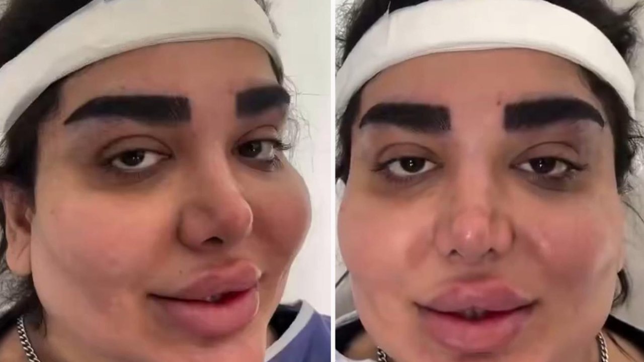 İran'da Estetik Operasyonu Tartışma Yarattı!