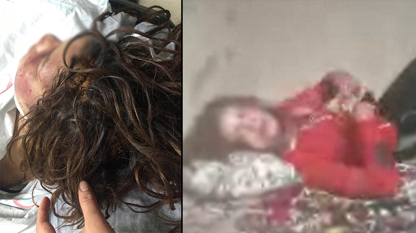 Şanlıurfa'da erkek şiddeti! Zincirle dövdü, tırnaklarını çekerek günlerce işkence yaptı