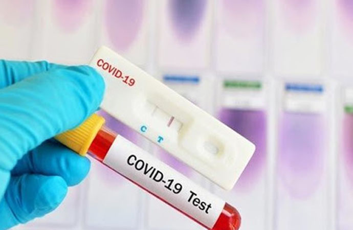 Sağlık Bakanlığı'nın Kovid-19 test kiti aldığı şirkette FETÖ detayı