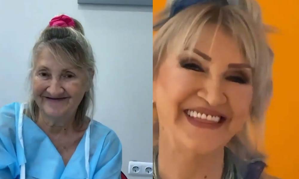 67 yaşındaki kadının estetik operasyonun ardından inanılmaz değişimi