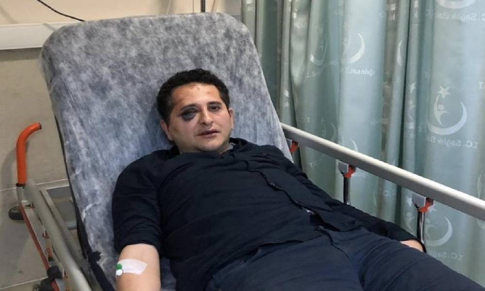 Cumhurbaşkanlığı korumaları tarafından dövülen avukatın davasında takipsizlik kararı!