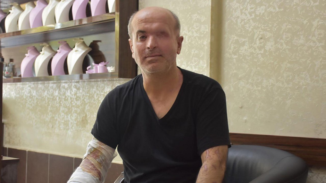 İzmir'de kezzaplı saldırı