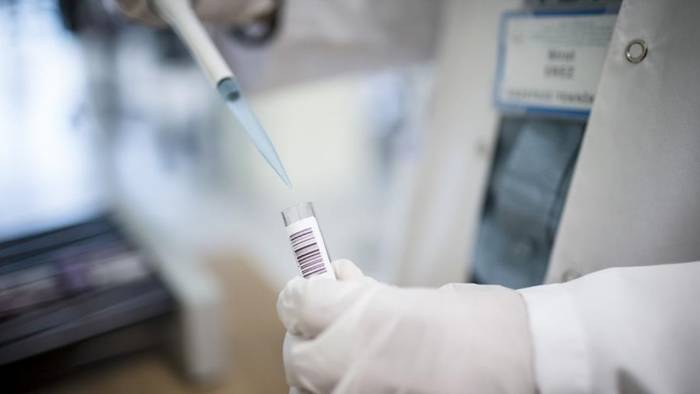 Nipah Virüsü Alarmı: Ölümcül mü, Nasıl Bulaşıyor, Türkiye Riskli mi, Pandemi Geri mi Geliyor?