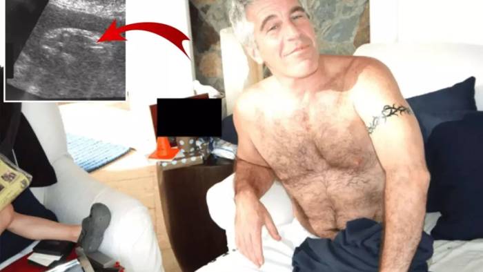Epstein Arşivinden Kan Donduran Kanıt: Gizli Doğumun Ultrason Görüntüsü İnfial Yarattı!